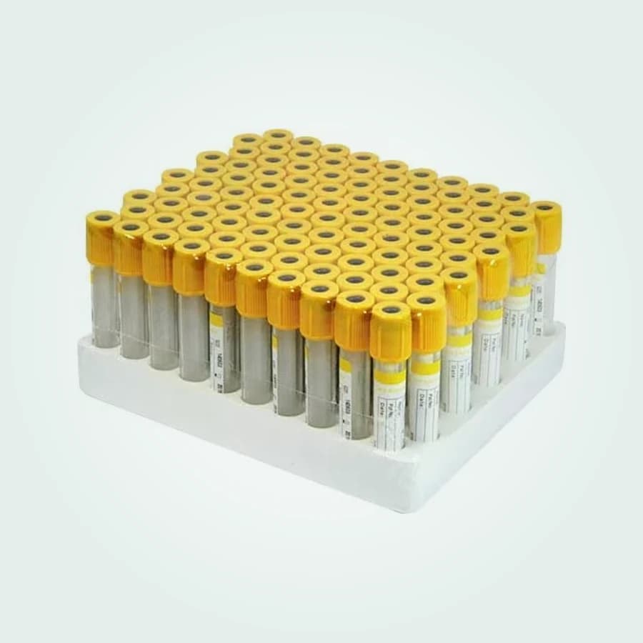Serum Separator Tubes